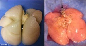 A la izquierda, el pulmón antes de su reconstrucción, a la derecha, tras la operación