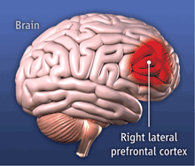 right-Lateral-Prefrontal-cortex